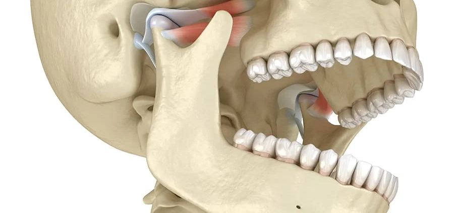 مفصل گیجگاهی